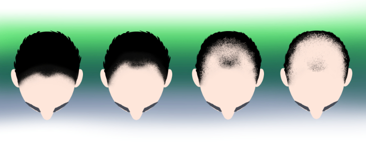 teledermatology.jpはじめての方